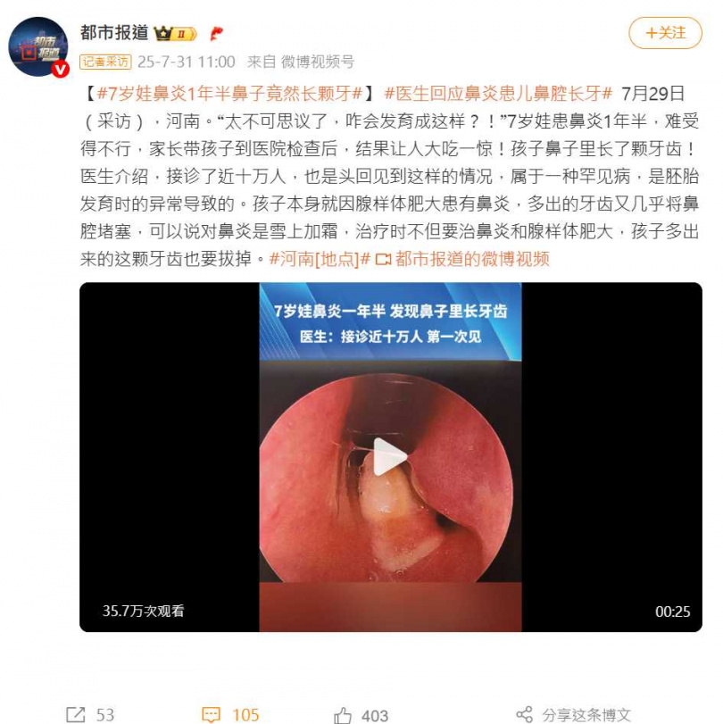 醫師透過電腦斷層檢查發現異常牙齒生長於鼻腔內，極為罕見。（圖／翻攝自微博）