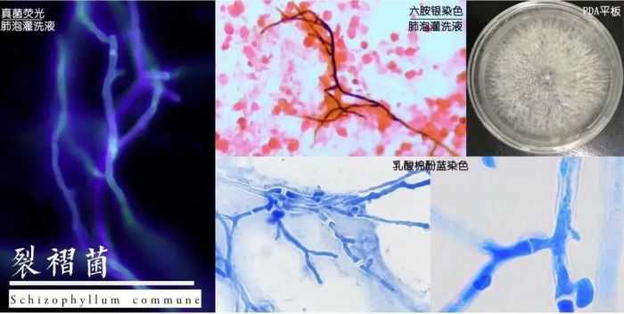 曲霉菌與裂褶菌孢子可能隨空氣飄散進入人體肺部。(圖/翻攝自極目新聞)