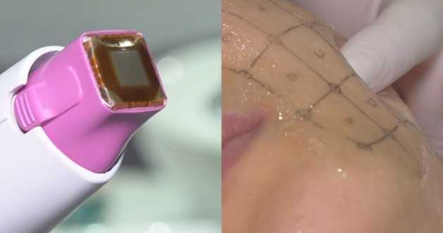 來自美國原廠正宗的鳳凰電波，有70幾項專利技術及70幾篇國際文獻佐證。（圖／CTWANT影音組拍攝）