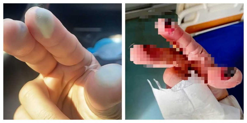 氫氟酸俗稱「化骨水」，具有極強腐蝕性，能侵蝕玻璃、金屬，甚至破壞人體骨骼，屬高危化學品。（示意圖／翻攝自快科技）