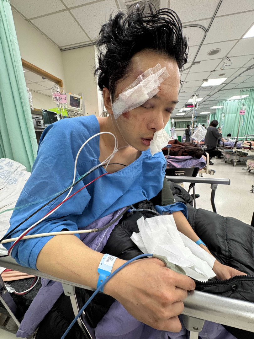 武行蘇德揚傷勢驚人。（圖／Rena提供）