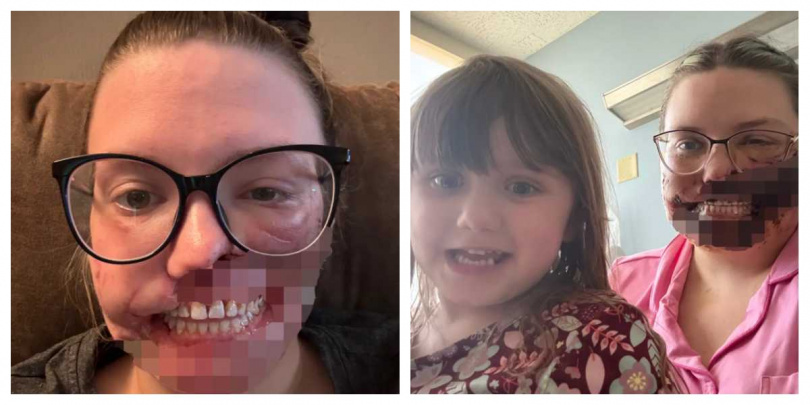 事件發生後，卡瑪戴維斯在家人協助下進行復原與日常生活。（圖／翻攝自Gofundme）