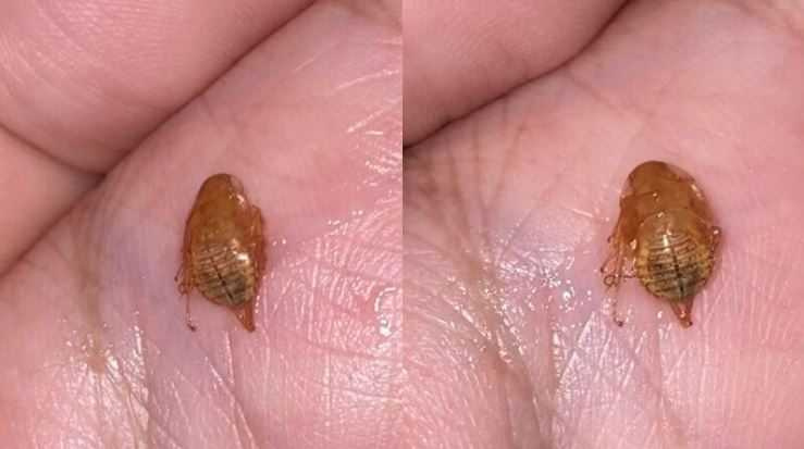 男子連續3天感到喉嚨不適，竟從口中咳出1隻不明生物。（圖／翻攝自Khaosod）