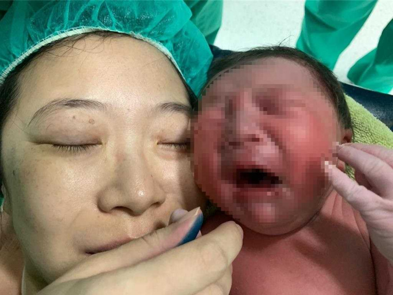 6月18日上午,36歲林姓產婦在大同醫院順利接受剖腹產,平安誕下重達3695公克的健康男寶寶。(圖/院方提供)