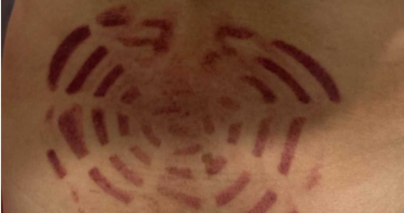 該名媽媽的傷勢。（圖／翻攝畫面）