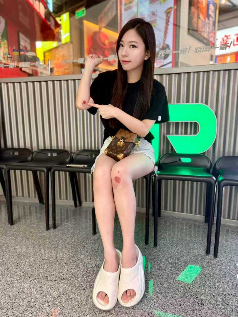 蔡尚樺近日在路邊跌倒。（圖／翻攝IG／蔡尚樺）