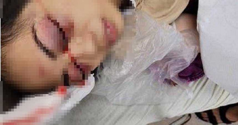 潘女傷勢嚴重。(圖/翻攝自爆料公社)