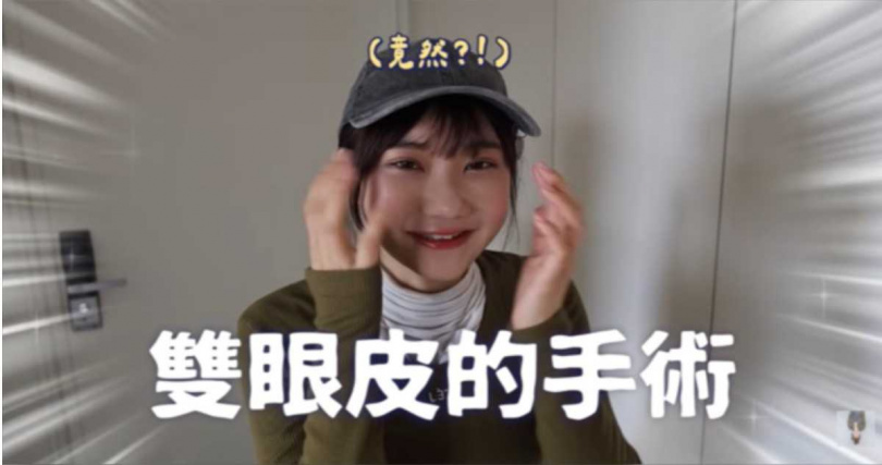 愛莉莎莎分享赴韓國割雙眼皮後的術後模樣。（圖／翻攝自YT，愛莉莎莎 Alisasa）