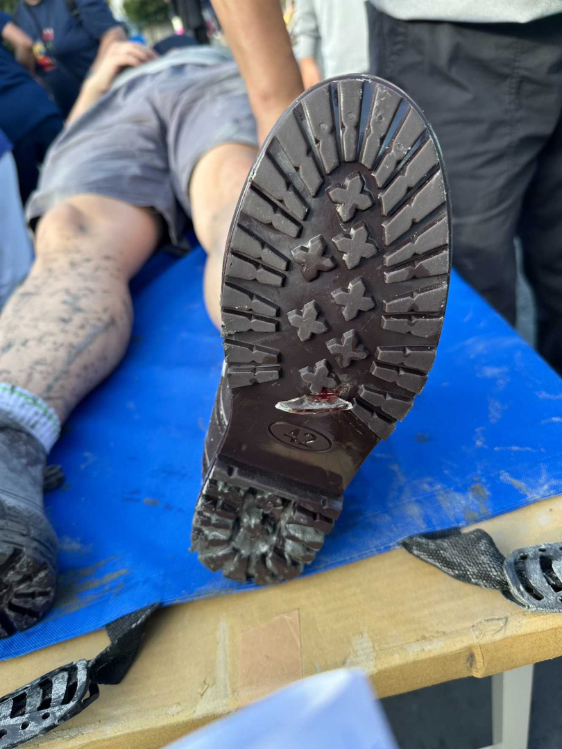 災後重建外科醫療需求增大，花蓮慈院3＋1＋N醫療支援不間斷。（圖／花蓮慈濟醫院提供）