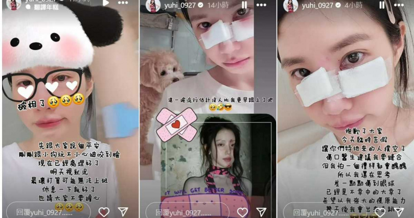 筠熹在IG報平安，所幸她的傷勢經就醫治療後無大礙。（圖／翻攝自Instagram／yuhi_0927）