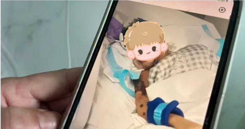 男童高燒40℃後病情急轉直下，24小時內出現大範圍皮膚變色壞死。（圖／翻攝自環球網）