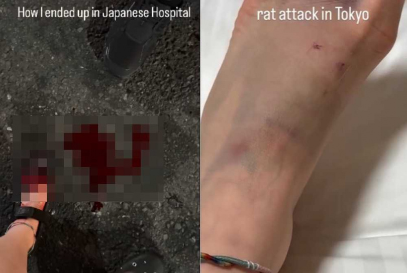 有一名從杜拜到日本旅遊的女子,在社群公開自己在東京新宿街頭被老鼠咬傷的事件,腳背流血又發黑,所幸就醫治療無大礙。(圖/翻攝自日網)