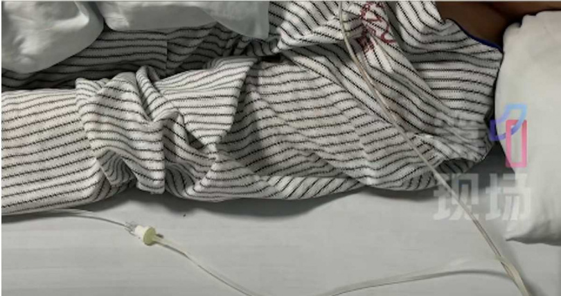 患者視野出現固定黑影且持續擴大，視力快速惡化。