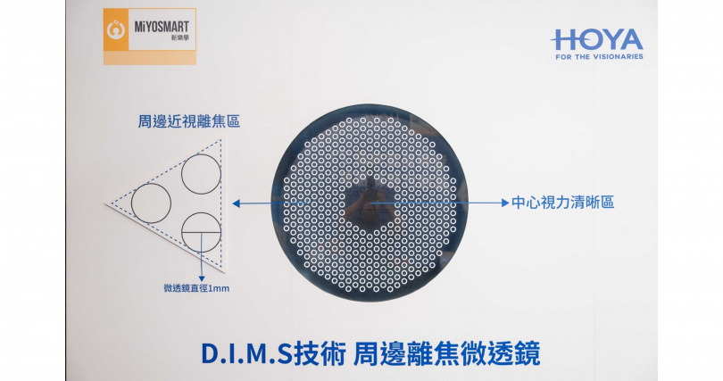 HOYA新樂學鏡片透過獨家的D.I.M.S.技術，鏡片中央提供清晰視力，同時透過周邊減緩眼軸增長，孩子白天正常配戴即可達到近視延緩效果。（圖片提供／HOYA）