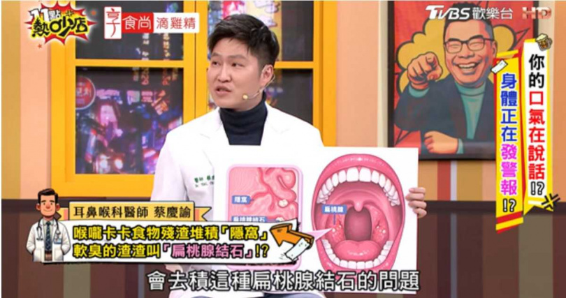 耳鼻喉科醫師指出，扁桃腺結石與隱窩構造有關，與清潔習慣無絕對關聯。（圖／翻攝自YT，11點熱吵店）