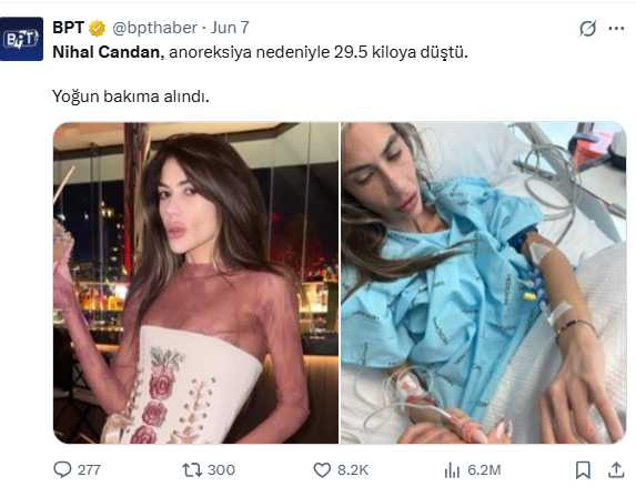 土耳其網紅兼實境節目女星因厭食症惡化於30歲時辭世，引發外界關注女性審美壓力。（圖／翻攝自X）