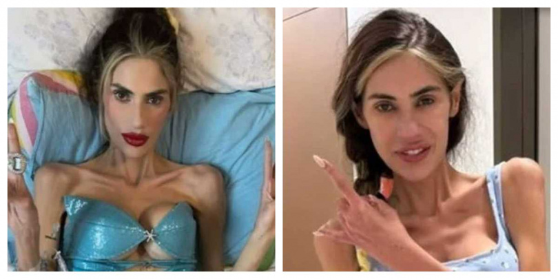 土耳其網紅兼實境節目女星因厭食症惡化於30歲時辭世，引發外界關注女性審美壓力。（圖／翻攝自Instagram @nihalcandann）