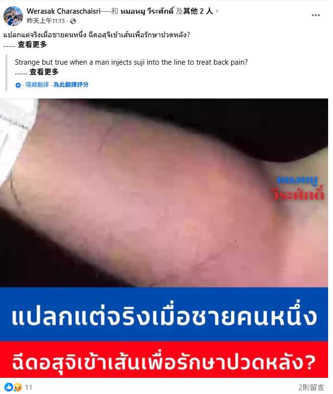 醫師威拉薩克透過臉書公開此病例，提醒民眾切勿相信偏方，自行注射極度危險。（圖／翻攝自臉書）