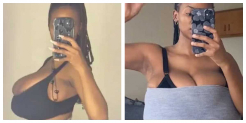 在網友集資幫助下，米雪兒於今年2月完成縮胸手術，縮至34D。（圖／擷取自IG，@michelle_kino）