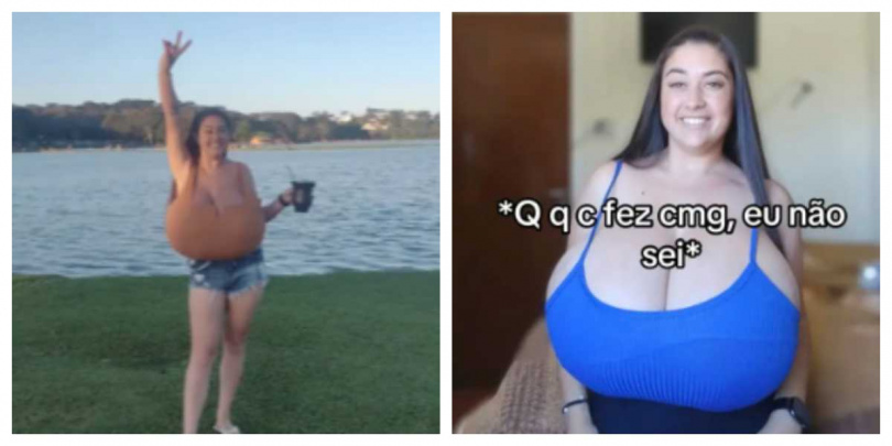 巴西女子塔伊娜拉切除約10公斤多餘乳房組織後重拾自信。（圖／擷取自IG，@thay_marcondes01）