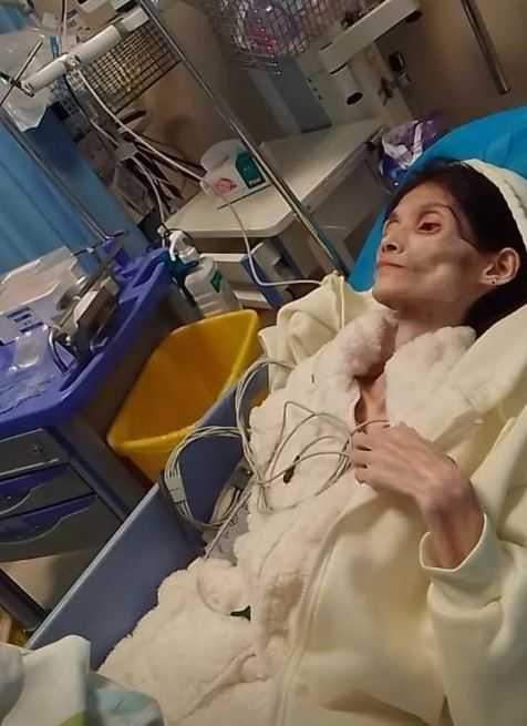 幾年前的巧巧還是一位容貌出眾、氣質溫婉的女子，與如今這副枯槁的模樣判若兩人。（圖／翻攝自微博）