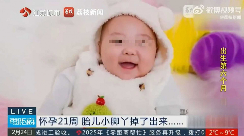 這名早產寶寶6個月大時,非常健康。(圖/翻攝自微博)