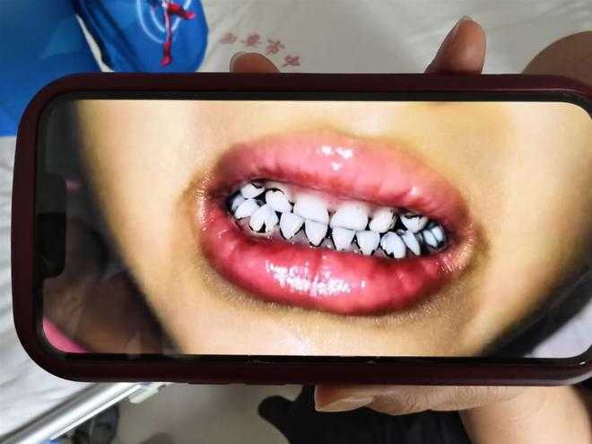 甘肅天水褐石培心幼兒園遭爆幼童血鉛超標，至少19人住院，園方已遭立案調查。（圖／極目新聞）