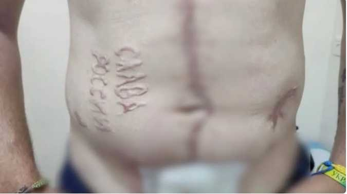 當安德烈的傷疤曝光時，一度引起許多網友震驚。（圖／翻攝X）