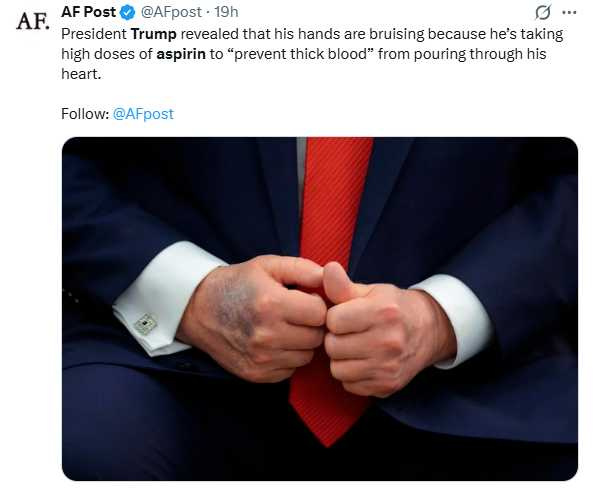 川普手部曾被拍到出現瘀青，他表示可能與長期服用阿斯匹靈有關。（圖／翻攝自X，@AFpost）