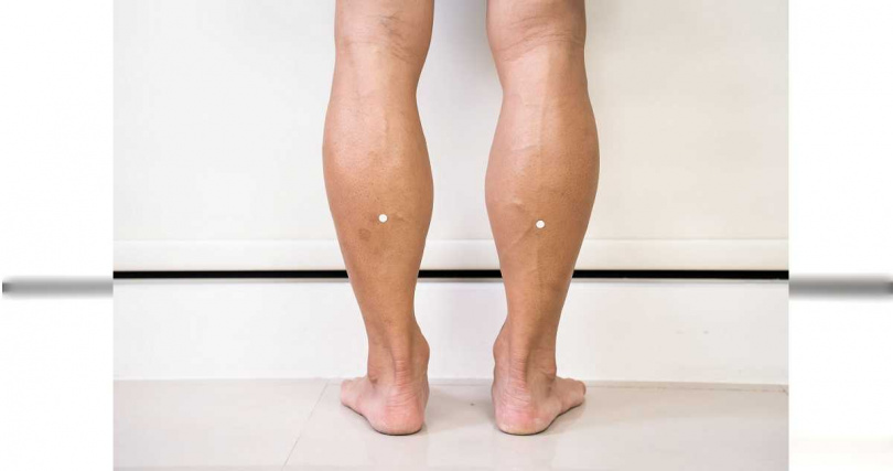 腿部2側的白點處為承山穴。（圖／劉宗昇提供）