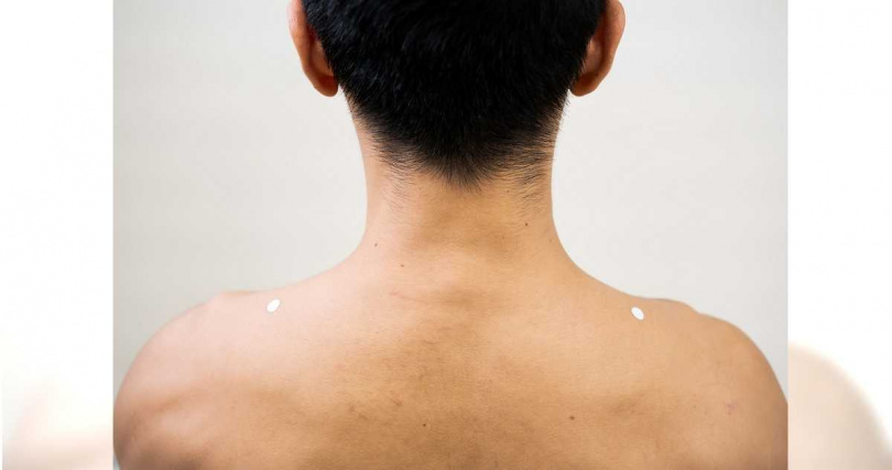 肩膀2側的白點處為肩井穴。（圖／劉宗昇提供）