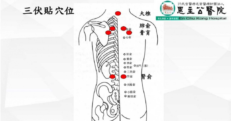 三伏貼穴位。(圖/張晉賢提供)