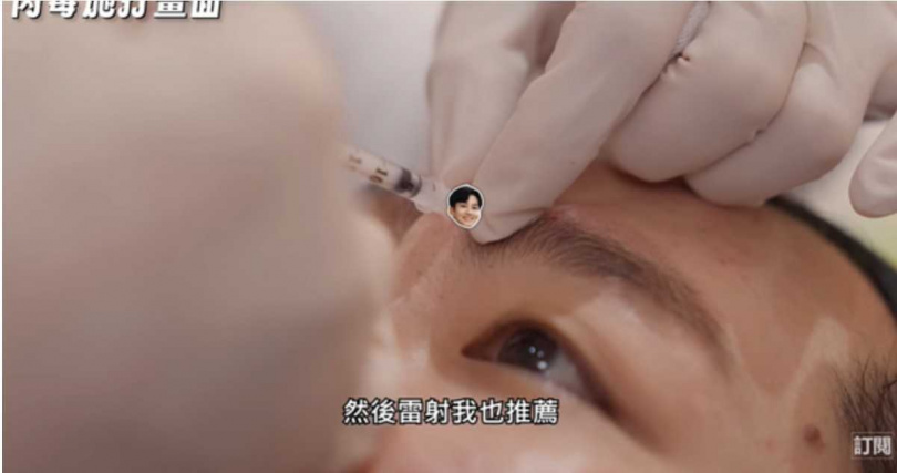 Joeman以影片親身分享醫美經歷，引發網友熱議與共鳴。（圖／翻攝自YT，Joeman）