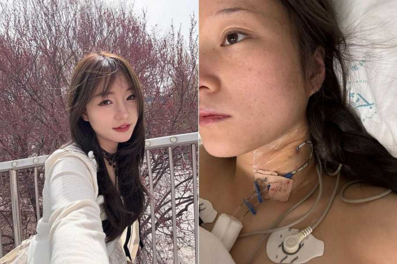 女子被醫生診斷為截癱。（圖／翻攝自極目新聞）