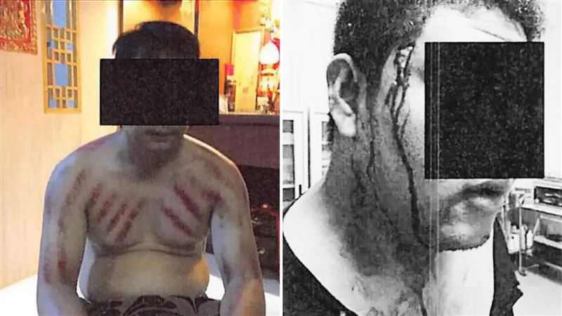 外媒報導指出，無論是自願或被拐賣去當地成為詐騙工的人，都可能淪為被凌虐的對象。（圖／翻攝自美國紐約東區地方法院）