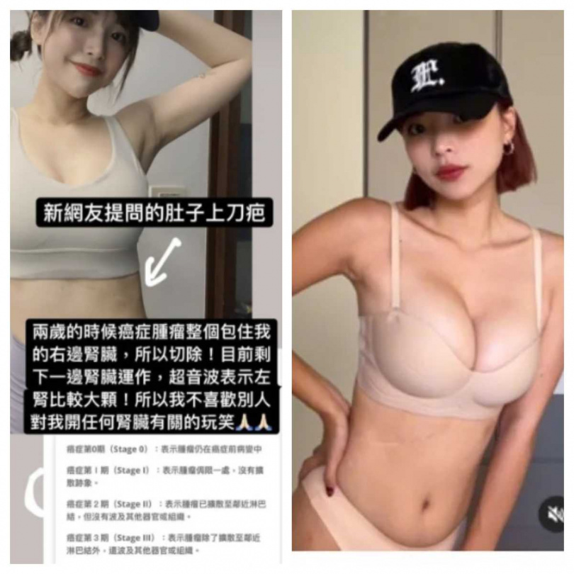 面對粉絲提問，一隻阿圓真誠回應「少了就少了，我還是我」。（圖／擷取自IG，G＠nanaciaociao） 