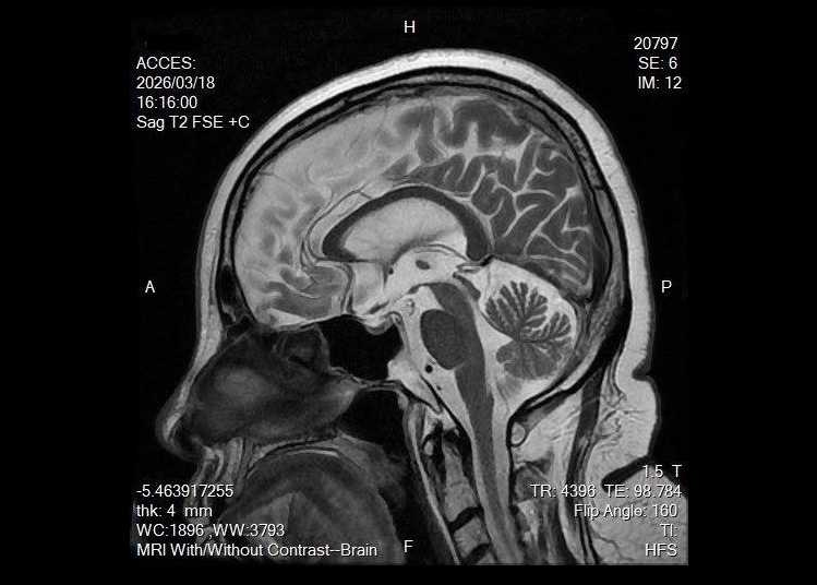 陳文茜公開自身最新病況。（圖／翻攝自臉書／文茜的世界周報 Sisy's World News）