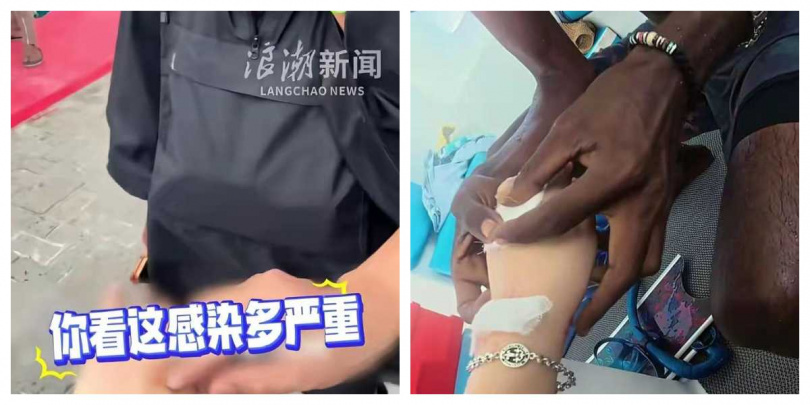 同行友人提醒恐感染需就醫，女子卻未當回事，引起網友爭議