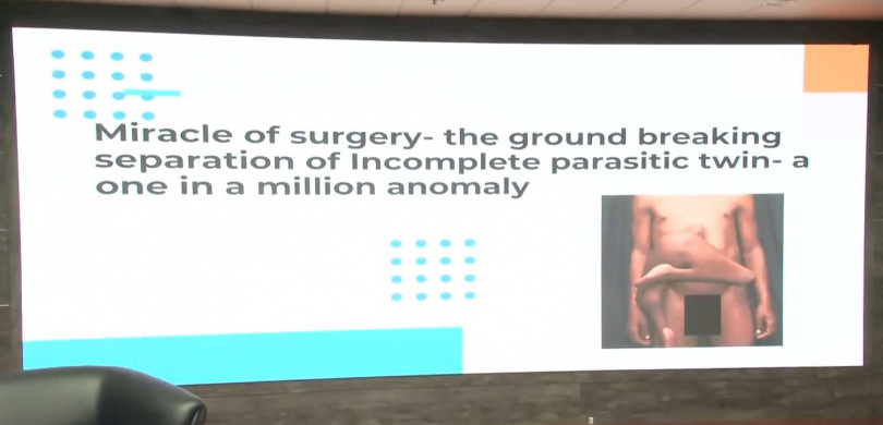 這類病例全球僅有42例，該手術由全印度醫學科學研究所（AIIMS）進行。（圖／Tahir Ibn Manzoor）