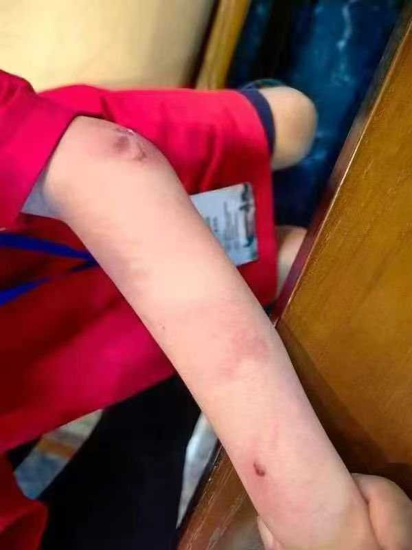 網路流傳朱宏鑫挨打後的照片。（圖／翻攝微博）