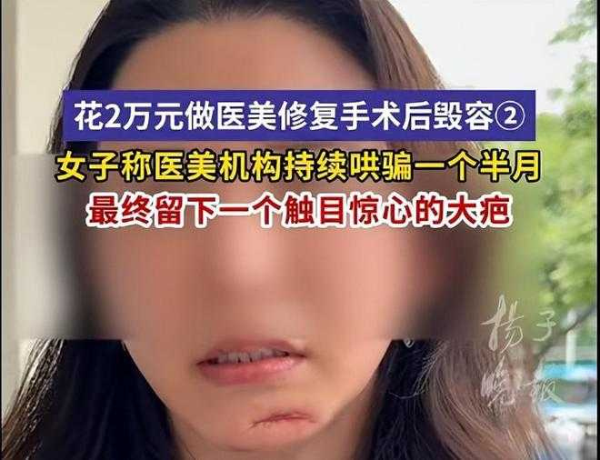 丁女術後面部「饅化」腫脹(圖/翻攝自揚子晚報)