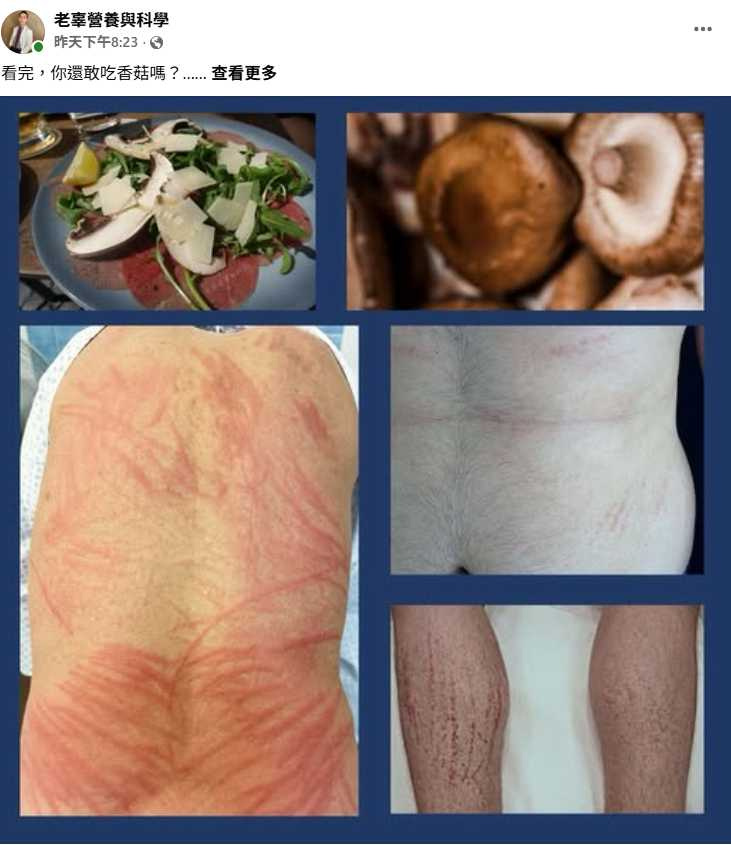 營養師提醒，生食或未完全煮熟的香菇，少數體質特殊者可能引發罕見的「香菇皮膚炎」，建議充分加熱後再食用。（圖／翻攝自臉書，老辜營養與科學&nbsp; ）