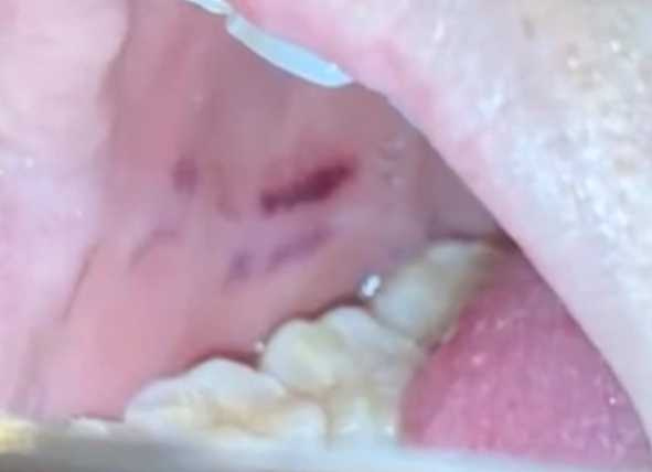 巫女口腔被炸出傷口，還被隨濃烈火藥味。（圖／翻攝自微博）