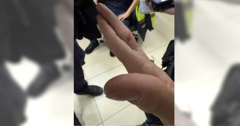 陳員準備實施酒測，不料謝男突對陳員揮拳攻擊，導致陳員右側脖子及左手中指處有明顯紅腫擦挫傷。（圖／警方提供／中國時報記者謝佳潾屏東傳真）