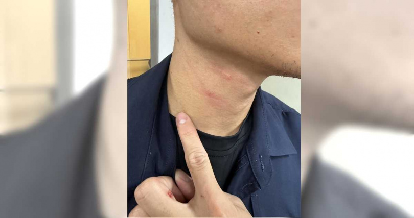 陳員準備實施酒測，不料謝男突對陳員揮拳攻擊，導致陳員右側脖子及左手中指處有明顯紅腫擦挫傷。（圖／警方提供／中國時報記者謝佳潾屏東傳真）