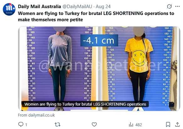 腿骨切除後由金屬固定，骨骼癒合後再拆除，醫師稱不留疤痕。（圖／翻攝自X， @DailyMailAU ）