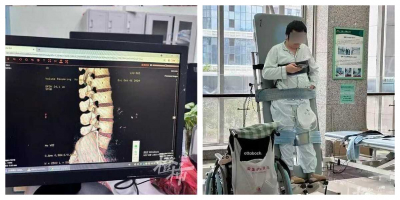 小山在海南參加衝浪課程時，不慎在完成起乘動作後閃傷腰部，最終診斷為脊髓損傷，導致終身癱瘓。（圖／橙柿互動、受訪者提供）