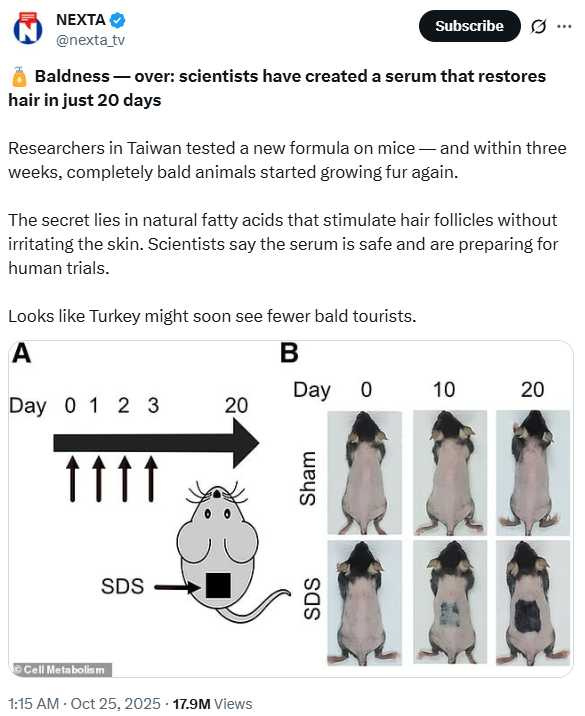 台大團隊研發「20天生髮精華」登國際。(圖/翻攝自X@nexta_tv)