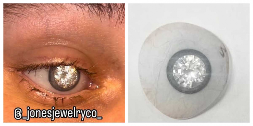 現年23歲的瓊斯自豪戴上全球最貴義眼，稱自己是「鑽石眼」。（圖／翻攝自IG，Slater Jones）