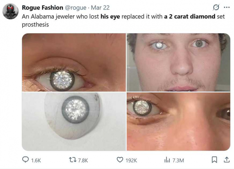 斯雷特．瓊斯展示嵌有2克拉鑽石的義眼，造價約新台幣6480萬元。（圖／翻攝自X，@rogue）